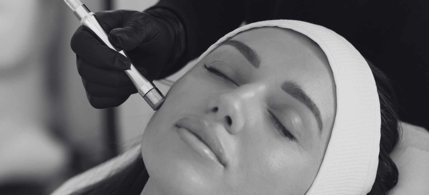 Treatment Spotlight: Dermabrasion Facials